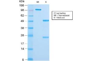 SDS-PAGE Analysis Purified CK18 Rabbit Recombinant Monoclonal Antibody (KRT18/2808R).