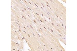 Immunohistochemistry of paraffin embedded mouse heart using USP24 (ABIN7076111) at dilution of 1:1000 (400x lens)