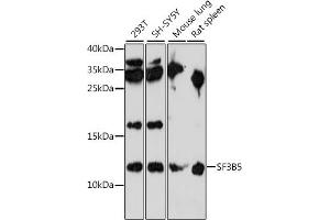 Western blot analysis of extracts of various cell lines, using SF3B5 antibody (ABIN7270546) at 1:1000 dilution. (SF3B5 anticorps  (AA 1-86))