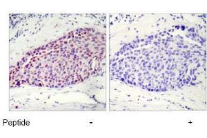 Image no. 1 for anti-Activating Transcription Factor 2 (ATF2) (Ser112), (Ser94) antibody (ABIN197152)