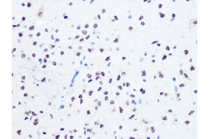 Immunohistochemistry of paraffin-embedded rat brain using OGG1 Rabbit mAb (ABIN7265349) at dilution of 1:100 (40x lens).