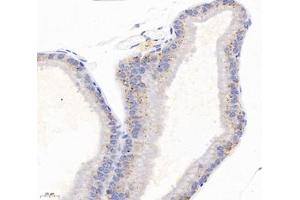 Immunohistochemistry analysis of paraffin-embedded rat prostate gland using,TSPAN1 (ABIN7075867) at dilution of 1: 4000