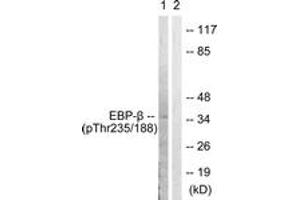 anti-CCAAT/enhancer Binding Protein (C/EBP), beta (CEBPB) (AA 201-250), (pThr235) antibody