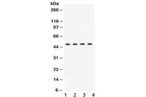 Western blot testing of human 1) HeLa, 2) HepG2, 3) MCF7, and 4) A549  lysate with BDKRB2 antibody at 0. (BDKRB2 anticorps  (AA 357-391))