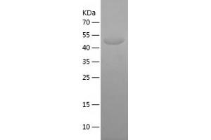 Western Blotting (WB) image for Potassium Voltage-Gated Channel, Shab-Related Subfamily, Member 1 (KCNB1) (AA 640-858) protein (His-IF2DI Tag) (ABIN7124533)