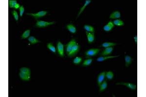 Immunofluorescence staining of Hela cells with ABIN7151703 at 1:133, counter-stained with DAPI.