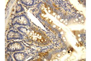 Immunohistochemical staining of CCR6 on formalin fixed, paraffin embedded rat intestine with CCR6 polyclonal antibody . (CCR6 anticorps  (N-Term))