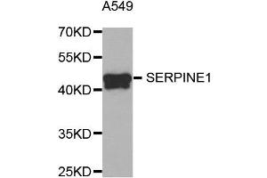 Western Blotting (WB) image for anti-Plasminogen Activator Inhibitor 1 (SERPINE1) antibody (ABIN1882338)