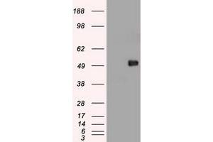 Image no. 11 for anti-Myc Proto-Oncogene protein (MYC) antibody (ABIN1497013) (c-MYC anticorps)