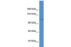 WB Suggested Anti-Kcnh8 Antibody   Titration: 1.