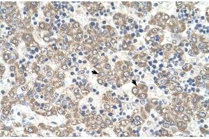 Immunohistochemical staining (Formalin-fixed paraffin-embedded sections) of human liver with KYNU polyclonal antibody . (KYNU anticorps  (AA 251-300))