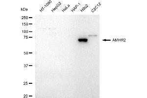 Western blotting analysis using AMHR2 antibody (ABIN7797628).