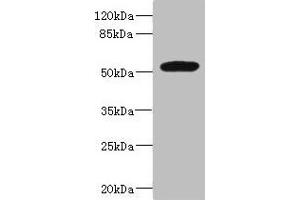 Western blot All lanes: MARCO antibody at 1. (MARCO anticorps  (AA 421-520))