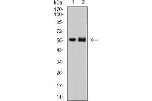 Western Blotting (WB) image for anti-Deoxynucleotidyltransferase, terminal (DNTT) (AA 52-192) antibody (ABIN5907278) (TdT anticorps  (AA 52-192))