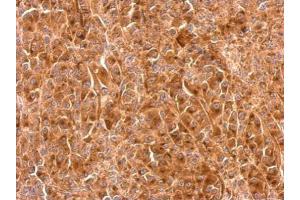 IHC-P Image Granulins antibody detects GRN protein at cytosol on HBL435 xenograft by immunohistochemical analysis.
