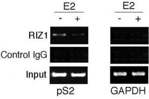 ChIP analysis: soluble chromatin was prepared from MCF7 cells treated/untreated with E2 for 45 min.