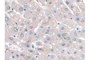 Detection of APOA1 in Human Liver Tissue using Monoclonal Antibody to Apolipoprotein A1 (APOA1)