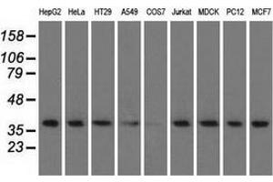 Western blot analysis of extracts (35 µg) from 9 different cell lines by using anti-HIBCH monoclonal antibody.