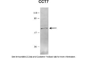 Sample Type: HEK 293 (10ug)Primary Dilution: 1:1000Secondary Antibody: conjugated goat anti-rabbitSecondary Dilution: 1:10,000Image Submitted By: Amy GrayBrigham Young University