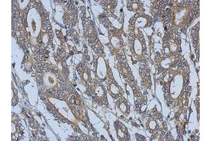 Image no. 1 for anti-Fermitin Family Member 3 (FERMT3) (AA 106-371) antibody (ABIN1501989)