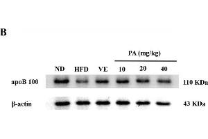 PA treatment attenuated HFD-induced apoB 100 reduction in rats. (APOB anticorps  (AA 28-330))