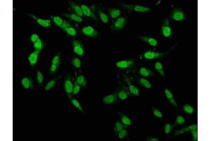 Immunofluorescence staining of Hela cells with ABIN7164137 at 1:100, counter-stained with DAPI.