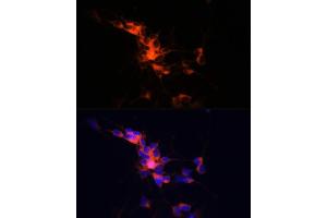 Immunofluorescence analysis of SH-SY5Y cells using βIII-Tubulin/β3-Tubulin Rabbit mAb (ABIN7271049) at dilution of 1:100 (40x lens).
