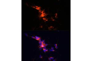 Immunofluorescence analysis of SH-SY5Y cells using βIII-Tubulin/β3-Tubulin Rabbit mAb (ABIN7271049) at dilution of 1:100 (40x lens). (TUBB3 anticorps)