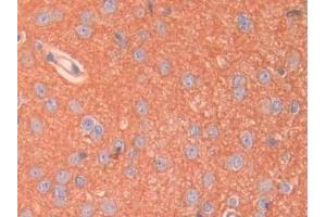 Detection of SPTAN1 in Rat Cerebrum Tissue using Polyclonal Antibody to Alpha-Fodrin (SPTAN1) (SPTAN1 anticorps  (AA 2071-2269))