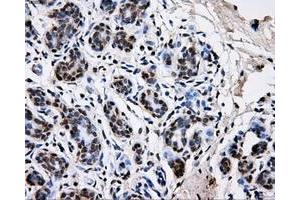 Immunohistochemical staining of paraffin-embedded breast tissue using anti-PKMYT1 mouse monoclonal antibody. (PKMYT1 anticorps)