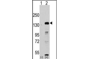 Western blot analysis of JHDM1a/FBXL11 (arrow) using rabbit polyclonal JHDM1a/FBXL11 Antibody (Center) (ABIN387896 and ABIN2844142). (KDM2A anticorps  (AA 500-527))