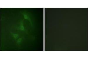 Immunofluorescence analysis of HeLa cells, using JNK1/2/3 (Ab-183/185) Antibody. (JNK anticorps  (AA 151-200))
