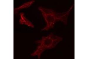 ABIN6275493 staining COLO205 cells by IF/ICC.