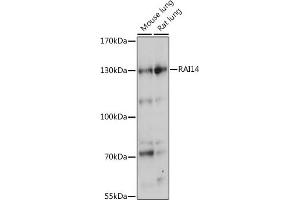 Western blot analysis of extracts of various cell lines, using R antibody (ABIN7269945) at 1:1000 dilution. (RAI14 anticorps  (AA 300-600))
