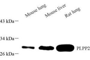 Western blot analysis of PLPP2 (ABIN7075037),at dilution of 1: 1500 (PPAP2C anticorps)