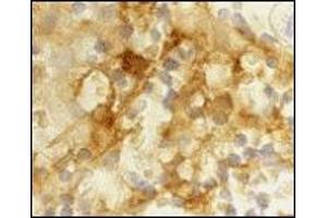 Immunohistochemistry (IHC) image for anti-CD209 (CD209) (Extracellular Domain) antibody (ABIN492510) (DC-SIGN/CD209 anticorps  (Extracellular Domain))