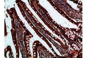 Immunohistochemical analysis of paraffin-embedded human-small-intestine, antibody was diluted at 1:200