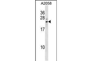 Western blot analysis in A2058 cell line lysates (35ug/lane). (LCN8 anticorps  (C-Term))