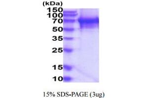 SDS-PAGE (SDS) image for Tyrosyl-DNA Phosphodiesterase 1 (TDP1) (AA 1-608) protein (His tag) (ABIN7281254) (TDP1 Protein (AA 1-608) (His tag))