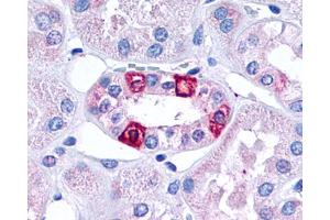 Anti-5HT1F Receptor antibody IHC of human kidney, renal tubules.