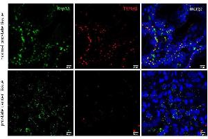 anti-RAP1A, Member of RAS Oncogene Family (RAP1A) (Center) antibody