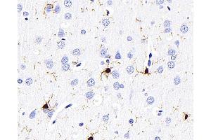 Immunohistochemistry analysis of paraffin-embedded Rat brain using AIF1 Monoclonal Antibody at dilution of 1:300.
