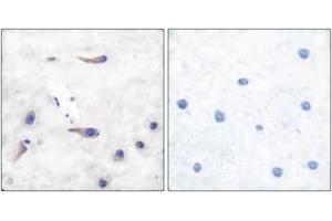 Immunohistochemistry analysis of paraffin-embedded human brain tissue, using MARCKS (Ab-163) Antibody. (MARCKS anticorps  (AA 136-185))