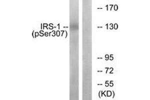 Western Blotting (WB) image for anti-Insulin Receptor Substrate 1 (IRS1) (pSer307) antibody (ABIN2888447) (IRS1 anticorps  (pSer307))