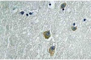 Immunohistochemistry (IHC) analyzes of PAKalpha antibody in paraffin-embedded human brain tissue. (PAK1 anticorps)