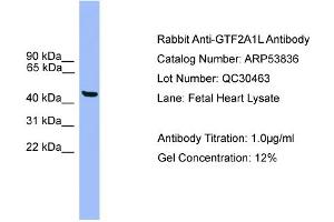 WB Suggested Anti-GTF2A1L  Antibody Titration: 0. (GTF2A1L anticorps  (C-Term))