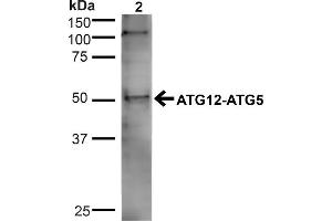 Western blot analysis of Human Cervical cancer cell line (HeLa) lysate showing detection of ~32. (ATG5 anticorps  (N-Term) (APC))
