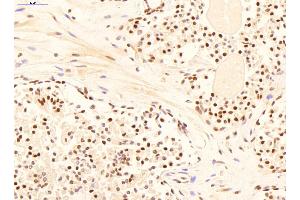 Immunohistochemistry (IHC) image for anti-14-3-3 epsilon (YWHAE) (C-Term) antibody (ABIN2779359)