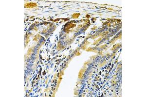 Immunohistochemistry of paraffin-embedded mouse intestine using RRAGC Antibody (ABIN5975563) at dilution of 1/100 (40x lens). (GTR2 anticorps)