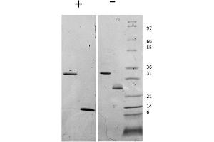 SDS-PAGE of Human Myostatin Propeptide Recombinant Protein SDS-PAGE of Human Myostatin Propeptide and Myostatin Recombinant Protein. (Myostatin Propeptide Protéine)